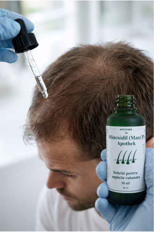 Cum se aplică Minoxidil 5% corect – dozaj, frecvență, pași de aplicare și rezultate reale 2 alt= minoxidil 5 apothek aplicare pe scalp dozaj corect